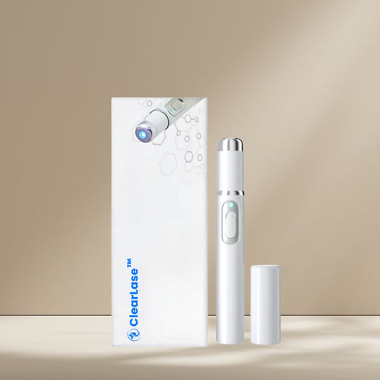 ClearLase ™ UK